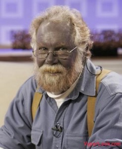 blue-skin-disorder
