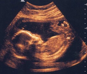 baby-in-a-womb1