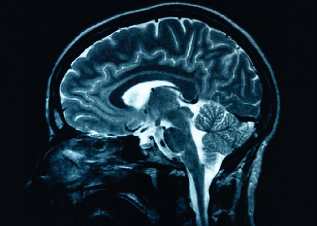brains1