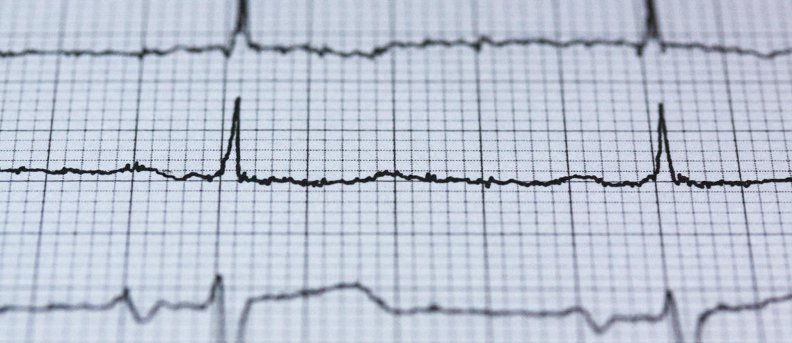 ECG graph to showcase a health insurance trend