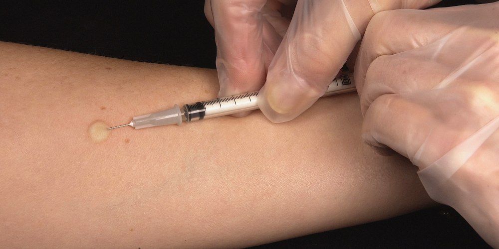 Gloved hand injecting needle with tuberculosis vaccine into arm