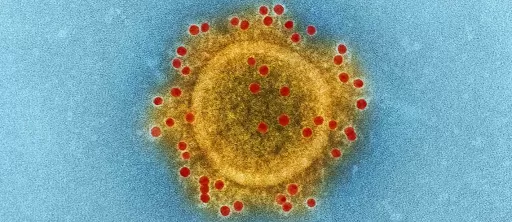 Electron microscope of virus