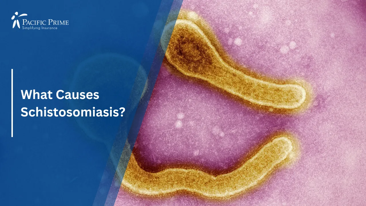 Image of Close-up View Of A Parasitic Worm Under Magnification with text overlay of "What Causes Schistosomiasis?"