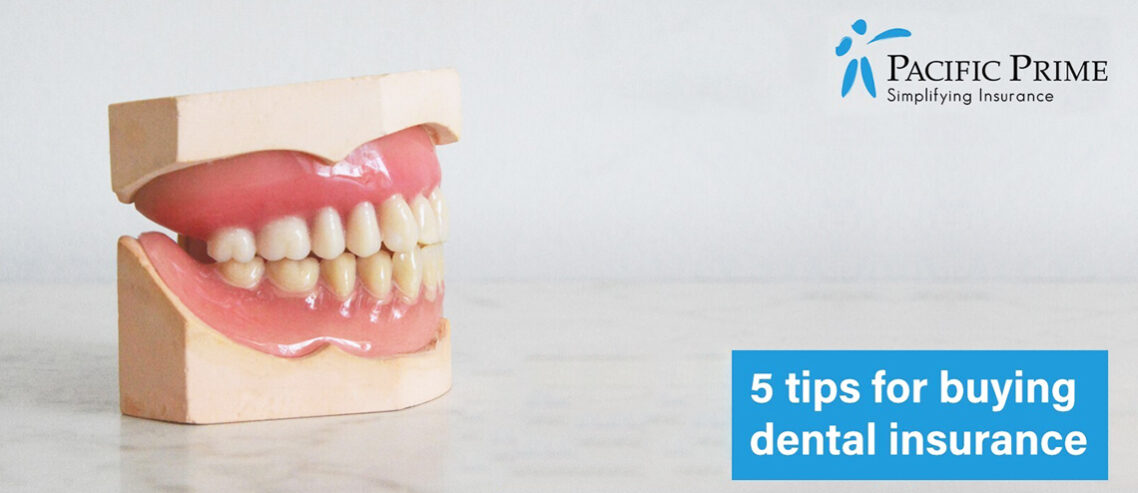5 tips for buying dental health insurance