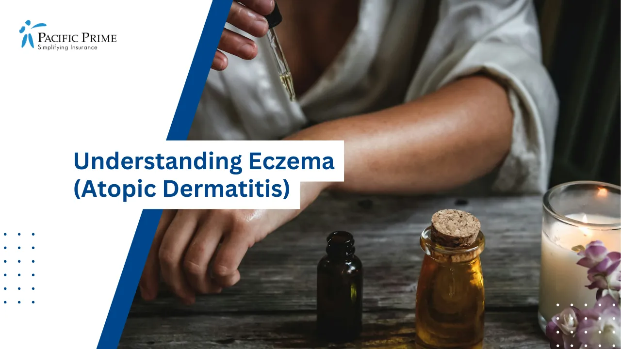 Image of Person Applying Oil To Dry Skin For Moisture with text overlay of "Understanding Eczema (Atopic Dermatitis)"