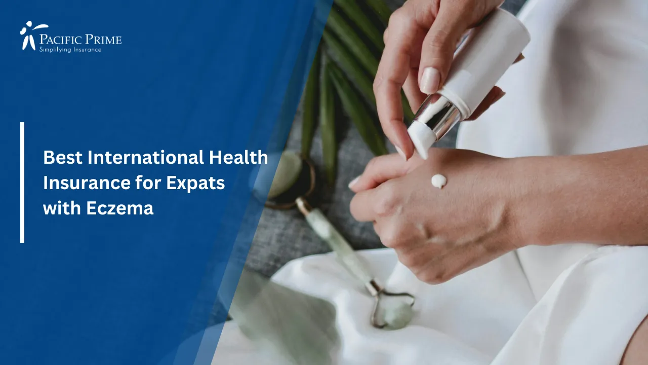Image of Person Pouring Moisturizing Cream From White Bottle Onto Hands with text overlay of "Best International Health Insurance for Expats with Eczema"