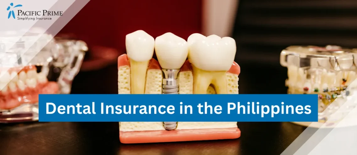 Image of White And Yellow Wooden Condiment Shakers with text overlay of "Dental Insurance in the Philippines"